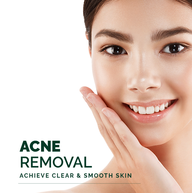 acne removal(SKIN)